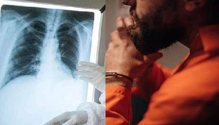 કેદીનો X-ray જોઇ ડોક્ટરના ઉડી ગયા હોશ, પેટમાં સંતાડ્યો હતો મોબાઇલ