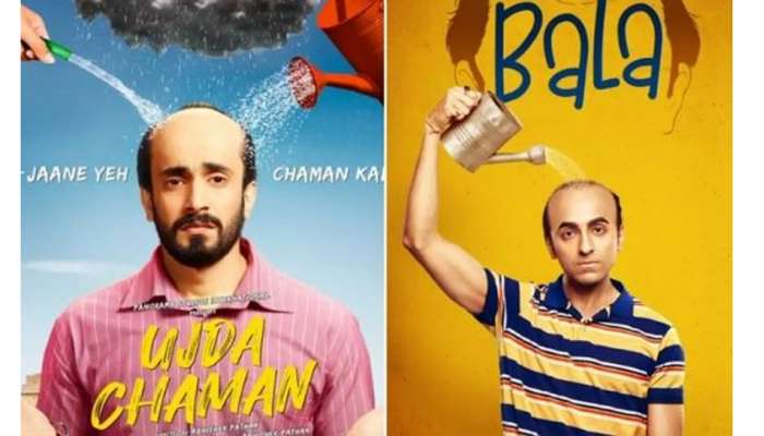 Hair Falls: મહિલાઓના માથામાંથી પણ વાળ ખરે છે, પરંતુ માત્ર પુરુષોને જ કેમ પડે છે ટાલ! જાણો