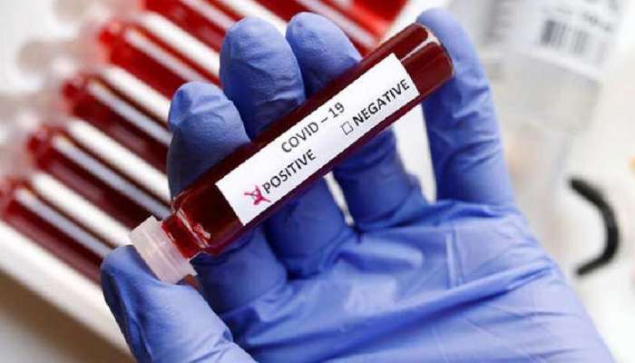 5th Omicron case in India : હવે દિલ્હીમાં મળ્યો ઓમિક્રોનનો કેસ, તાન્ઝાનિયાથી પરત આવેલો વ્યક્તિ પોઝિટિવ