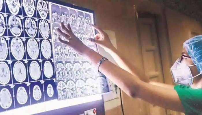 શું ફરી પાછી આવશે બ્લેક ફંગસ?  દેશમાં આ જગ્યાએ મળ્યો પ્રથમ દર્દી