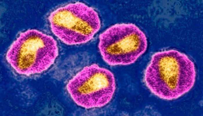 આખરે કાળા માનવી સામે HIV જેવી જીવલેણ બિમારી પણ હારી; પહેલીવાર કોઈ મહિલાને HIV સંપૂર્ણ રીતે મટી ગયો