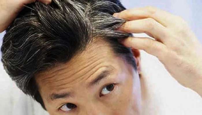સફેદ વાળની સમસ્યાથી છો પરેશાન? ખોટા અખતરા કર્યા વિના અપનાવો આ પ્રોપર ઉપાય