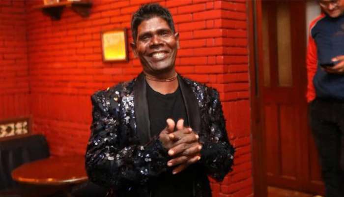 Kacha Badam: 'કચ્ચા બાદામ' ફેમ સિંગરનો થયો અકસ્માત, જાણો કેવી છે તેમની તબિયત