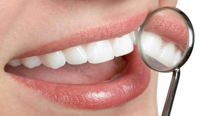 દાંતની સમસ્યાથી પરેશાન છો, તો આ 3 ઘરેલું ઉપાય દૂર કરશે તમારી મુશ્કેલીઓ
