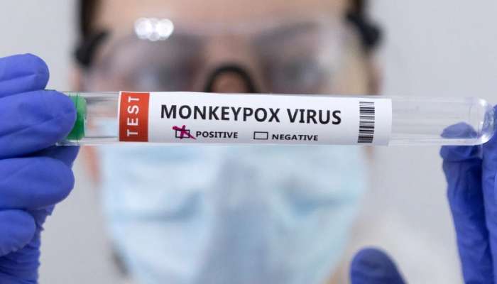 દિલ્હીમાં મંકીપોક્સનો વધુ એક કેસ નોંધાયો, 35 વર્ષીય વ્યક્તિ થયો સંક્રમિત