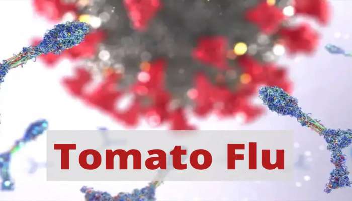 Tomato Flu: તમારા બાળકોનું રાખો ખાસ ધ્યાન, કોરોના બાદ આ વાયરસ માત્ર બાળકોને બનાવી રહ્યો છે શિકાર