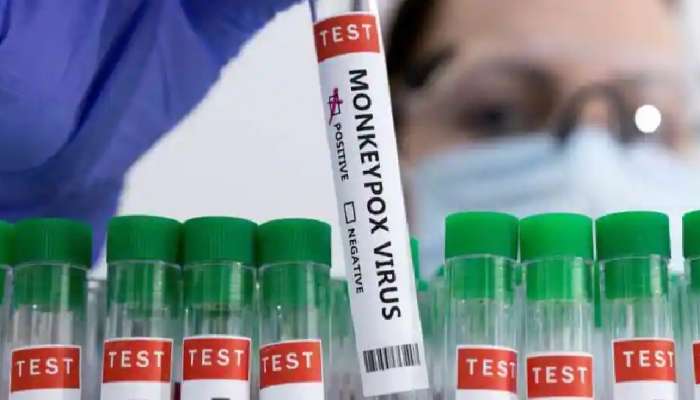 ઇટાલીમાં વ્યક્તિને એક સાથે થયો HIV, કોરોના અને મંકીપોક્સ, કર્યું હતું સમલૈંગિક સેક્સ