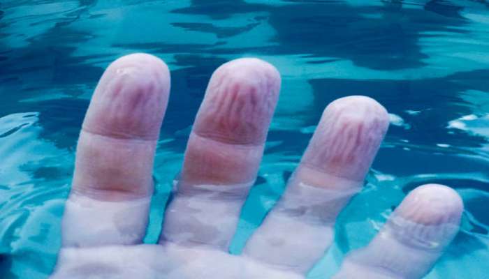 શું તમે હાથની આંગળીઓનો આ જાદુ જાણો છો? પાણીમાં થઈ જતા જ કેમ ફુલાઈ જાય છે, આ રહ્યું ક