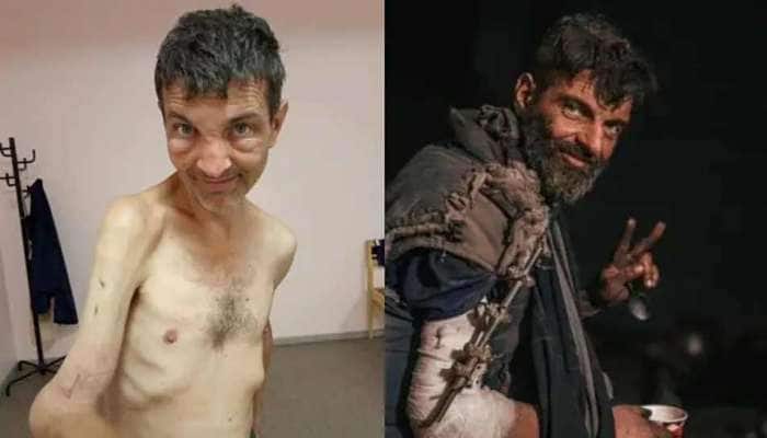 Russia-Ukraine War: રશિયાની કેદનો કહેર, હાડપિંજર જેવો બની ગયો યૂક્રેની સૈનિક