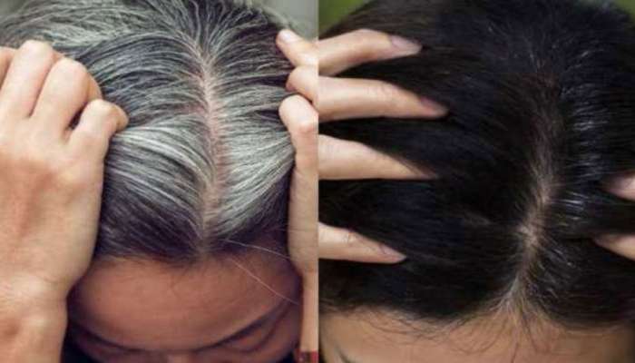 Hair Care Tips : આ માસ્ક તમારા સફેદ વાળને કાળા બનાવશે, હેર કલરનો ખર્ચો પણ બચશે