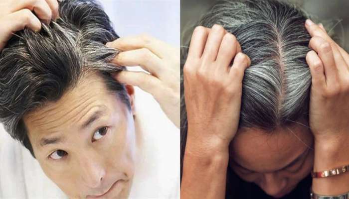 Oil For White Hair: આ દેશી તેલ કરશે કમાલ, સફેદ વાળ ફરી થઈ જશે કાળા