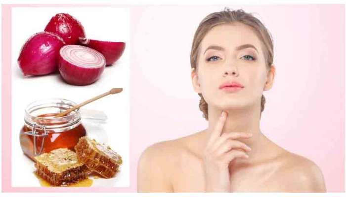 Beauty Remedies: ડુંગળીમાં મિક્સ કરી લગાવો આ વસ્તુ, ચાંદ જેવું ચમકશે મુખડું