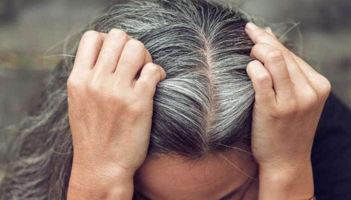 White Hair: કિચનમાં રાખેલા આ બીજથી સફેદ વાળ થઈ જશે કાળા, આ રીતે કરો ઉપયોગ White Hair: કિચનમાં રાખેલા આ બીજથી સફેદ વાળ થઈ જશે કાળા, આ રીતે કરો ઉપયોગ