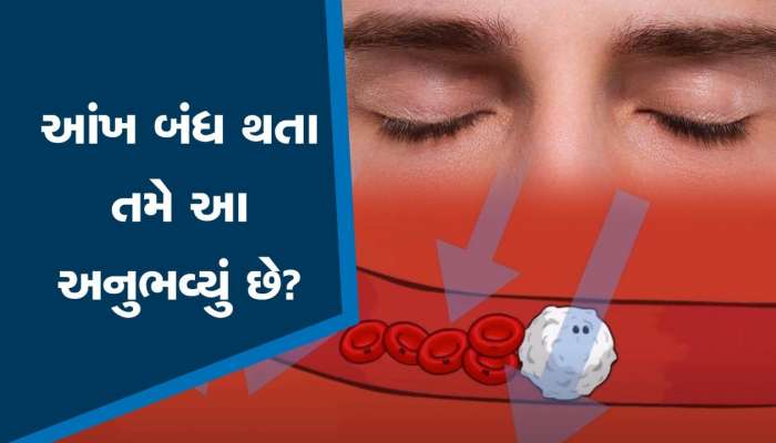 MUSCAE OF EYE: ઘણી વખત આંખોની સામે નાચવા લાગે છે અજીબ કીડાઓ, જાણો એની પાછળનું શું છે કારણ