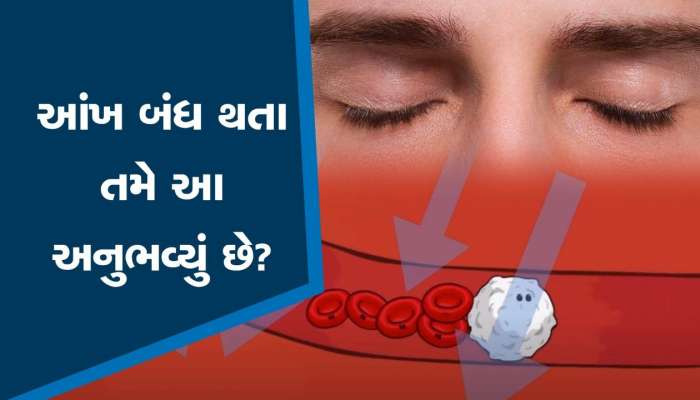 ઘણી વખત આંખોની સામે નાચવા લાગે છે અજીબ કીડાઓ, જાણો એની પાછળનું શું છે કારણ