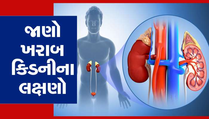 શરીરમાં દેખાતા આ લક્ષણ છે ખરાબ Kidney ના સંકેત, આ રીતે ઓળખો