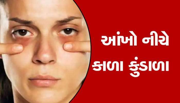 ચહેરાની સુંદરતા ઓછી કરતા કાળા કુંડાળાને ઘરેલું ઉપચારથી કરો દૂર, ભૂલેચૂકે ન કરો આ કામ