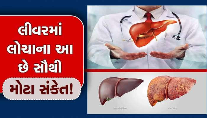 Liver Disease Symptoms: લીવરમાં લોચાના આ છે સૌથી મોટા સંકેત! તમે પણ જરૂર કરજો ચેક