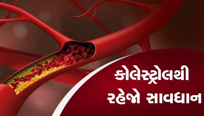 Cholesterol: યુવાનો પણ હાઈ કોલેસ્ટ્રોલથી રહેજો સાવધાન, આ લક્ષણોથી રહેજો સાવચેત