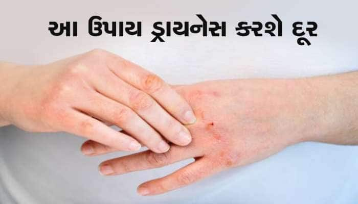 Dry skin home remedies: ઠંડીના લીધે સ્કીન ફાટી જાય છે, તો કરો આ ઘરેલુ ઉપાય