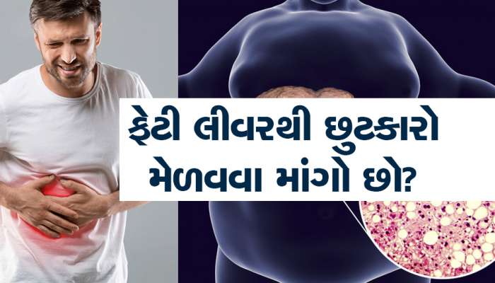 લીવરમાં તકલીફ હોય તો લાઈટલી ના લેતા! ખાવા-પીવામાં આ બાબતોનું રાખજો ખાસ ધ્યાન