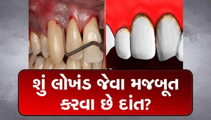 સ્વીટ સ્માઈલ માટે માત્ર આટલું જ કરો, દાંત થઈ જશે મજબૂત અને ચમકદાર