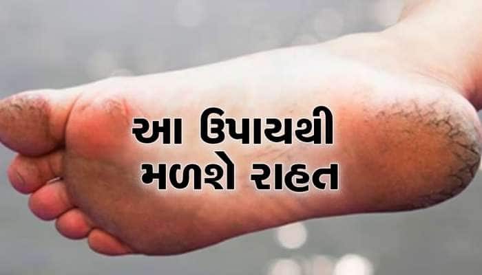 શિયાળામાં પગની એડીઓને મુલાયમ બનાવવી છે તો આ ઘરેલું ઉપાયો અજમાવો, મળશે ફાયદો