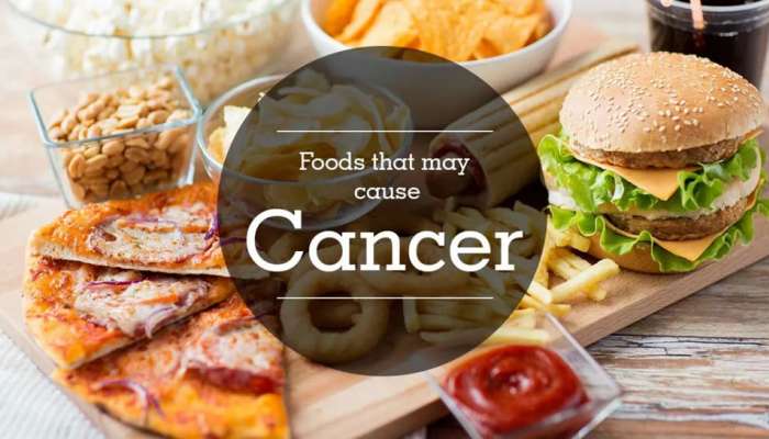 World Cancer Day 2023: એક નહીં 34 પ્રકારના કેન્સરને આમંત્રણ આપે છે આ ફૂડ, તમે તો નથી ખાતા ને