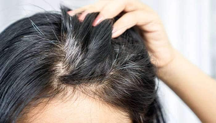 રસોડામાં રોજ વપરાતી આ વસ્તુ સફેદ થયેલા વાળને કરશે કાળા, જાણો કેવી રીતે કરવો  ઉપયોગ | LifeStyle News in Gujarati white hair problem solution use methi  benefits