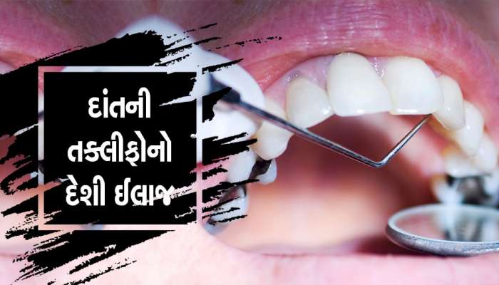 Teeth Cavities: શું તમે પણ દાંતમાં કેવિટી કે સડાથી પરેશાન છો ? આ ઉપાયથી મેળવો છુટકારો