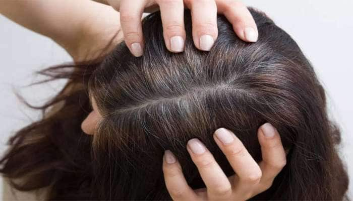 Hair Care: રાત્રે વાળમાં આ વસ્તુ લગાવીને સુઈ જાવ, સવારે સફેદ વાળ થઈ ગયા હશે કાળા