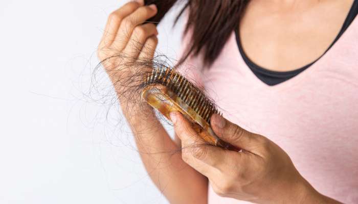 Hair Fall: હાથ લગાવતાની સાથે જ વાળ આવી જતા હોય હાથમાં તો તુરંત કરાવો આ ટેસ્ટ