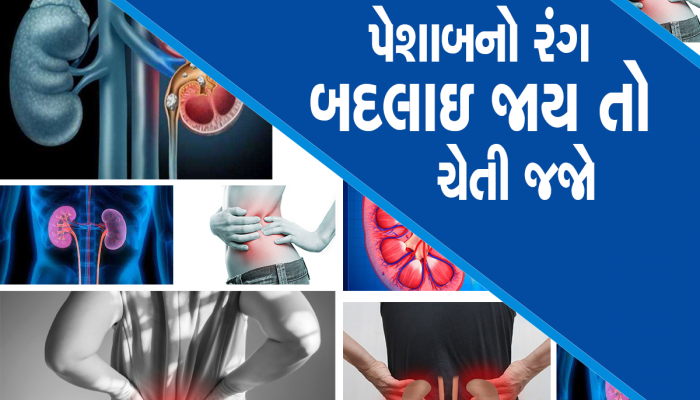 Warning Signs: આ સંકેતો દેખાડે છે કે તમારી કિડની ખતરામાં છે, સમયસર થઈ જજો સાવધાન