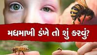 મધમાખી ડંખ મારે પછી તરત જ કરો આ ઘરગથ્થુ ઉપચાર,  સોજા અને દુખાવામાં મળશે રાહત 