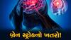 Brain Stroke Symptoms: દર 4માંથી એક યુવાનને બ્રેન સ્ટ્રોકનું જોખમ! શરૂઆતનાં 4 કલાક નિર્ણાયક, FAST રૂલ તમને બચાવી શકે છે