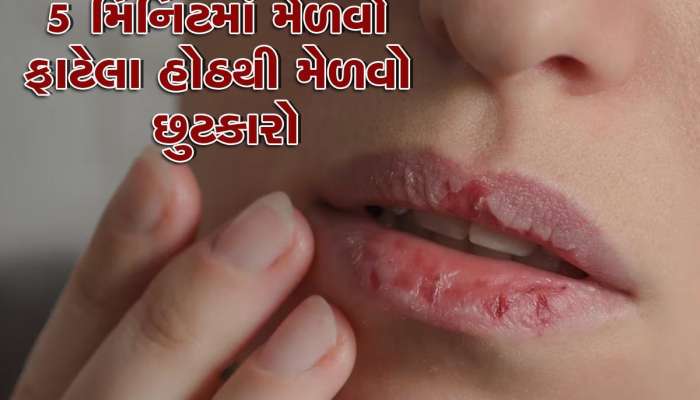 હોઠ ફાટી ગયા છે તો કાકડી બનાવશે કોમળ, આ રીતે ઉપયોગ કરો દરેક સમસ્યા થઈ જશે દૂર