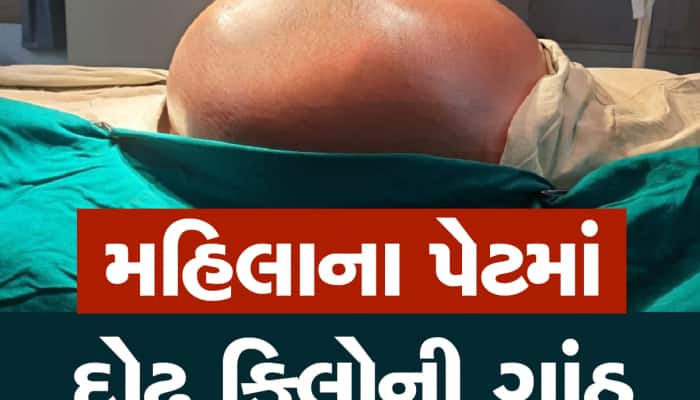 ગરીબ મહિલાને ભગવાન મળ્યા, તબીબોએ પેટમાં થયેલી દોઢ કિલોની ગાંઠમાંથી મુક્તિ અપાવી