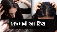 ફક્ત 10 રૂપિયામાં જ  ડેન્ડ્રફથી મળી જશે છૂટકારો, આ ઘરેલૂ નુસખા અજમાવો