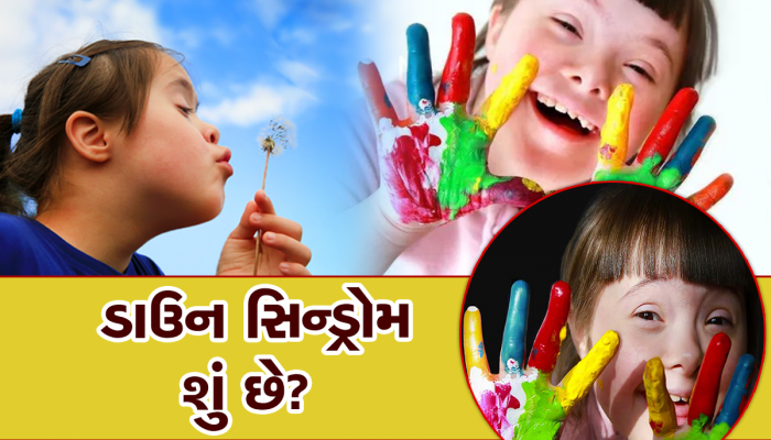 World Down Syndrome Day 2023: જાણો શા માટે ઉજવવામાં આવે છે વર્લ્ડ ડાઉન સિન્ડ્રોમ ડે