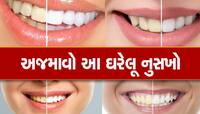 પીળા દાંત સફેદ મોતી જેવા ચમકાવવા છે તો 5 રૂપિયા કરી લો ખર્ચ, હસતા નહી આવે શરમ