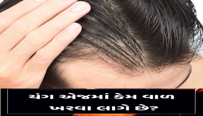 Baldness : માથામાંથી વાળ ખરી જાય છે અને ટકલાપણું ટાળવું હોય તો બસ આ કરો ઉપાય