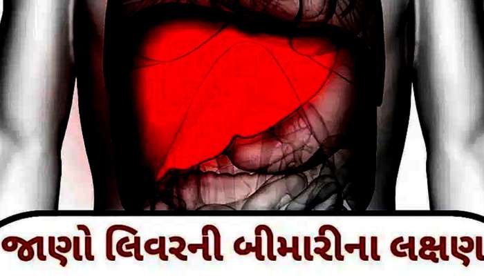 જો શરીરમાં દેખાય આ 5 સંકેતો તો તુરંત બદલી નાંખો કેટલીક આદતો, નહીં તો ફેલ થઈ જશે લીવર!