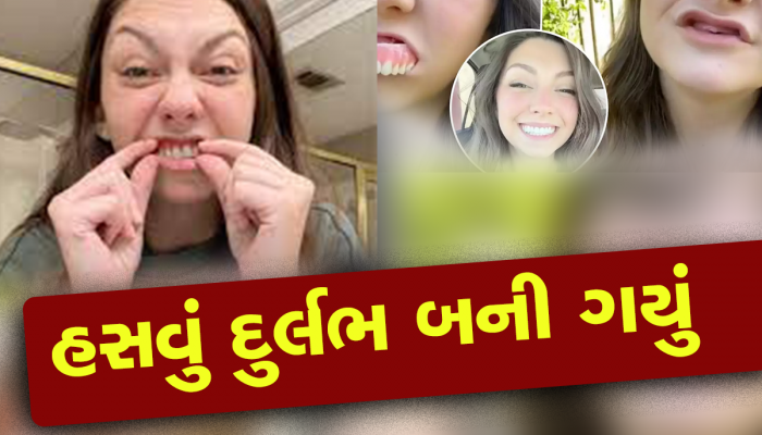 OMG! છોકરીના બધા દાંત 30 વર્ષની ઉંમરે પડી ગયા : હવે 27 લાખ રૂપિયા છે દાંતનો ખર્ચ