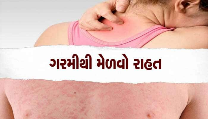 શરીર પર નીકળતી ગરમીથી પરેશાન છો, કરો આ ઘરેલું ઉપાય, ગરમીથી મળશે છુટકારો