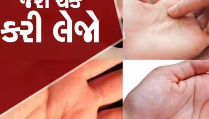 Palmistry: શું તમારી હથેળીમાં પણ છે આ નિશાન? રાજયોગનો આપે છે સંકેત, મળશે પુષ્કળ ધન