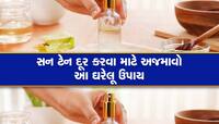 Summer Skin Care: Sun Burn થી છુટકારો મેળવવા માંગો છો?  ઘરે બનાવો આફ્ટર સન સ્પ્રે