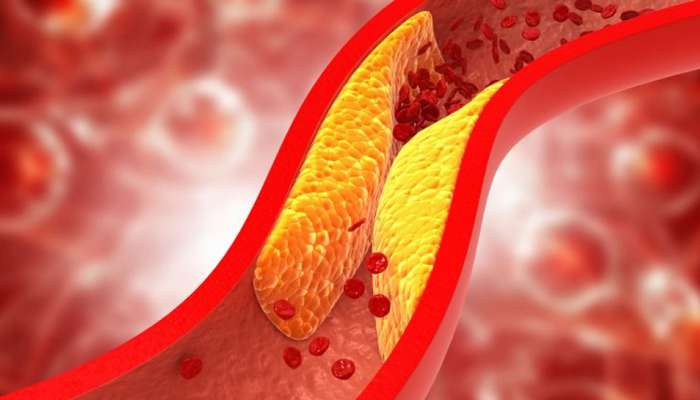 High Cholesterol દુર કરવું હોય તો રોજના આહારમાં આ 5 શાકભાજીનો કરો સમાવેશ
