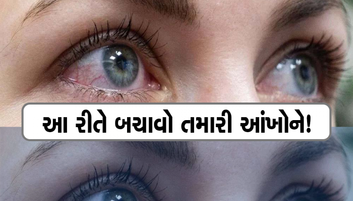 અમદાવાદ સહિત ગુજરાતભરમાં ડ્રાય આંખના દર્દીઓમાં વધારો; જાણો આંખોને શુષ્ક કરી નાખતી આ બિમારી કેટલી છે ગંભીર 