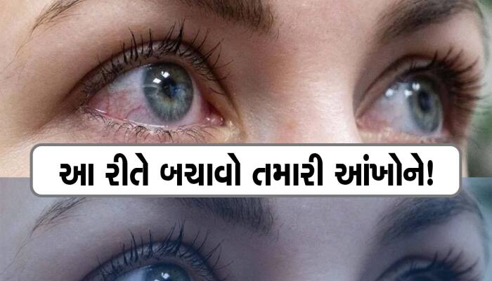 ગુજરાતભરમાં ડ્રાય આંખના દર્દીઓમાં વધારો; આંખોને શુષ્ક કરી નાખતી આ બિમારી કેટલી ગંભીર