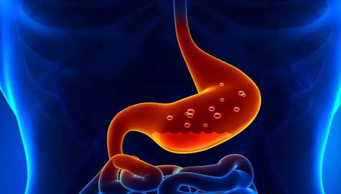 Home Remedy For Acidity: જમ્યા પછી થતી છાતીમાં બળતરાની તકલીફથી તુરંત આરામ આપે છે આ વસ્તુઓ